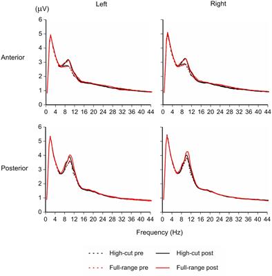 High-Resolution Audio with Inaudible High-Frequency Components Induces a Relaxed Attentional State without Conscious Awareness